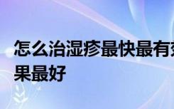 怎么治湿疹最快最有效湿疹用什么药膏治疗效果最好