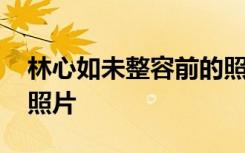 林心如未整容前的照片 林心如整容前后对比照片