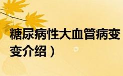 糖尿病性大血管病变（关于糖尿病性大血管病变介绍）