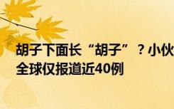 胡子下面长“胡子”？小伙患罕见病“皮肤毛发移行疹”，全球仅报道近40例