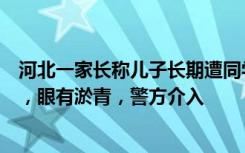 河北一家长称儿子长期遭同学欺负，大腿多处被圆规扎出血，眼有淤青，警方介入