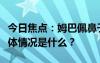 今日焦点：姆巴佩鼻子受伤赛后送医治疗，具体情况是什么？