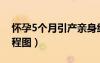 怀孕5个月引产亲身经历（怀孕5个月引产过程图）