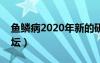 鱼鳞病2020年新的研究方法治疗（鱼鳞病论坛）