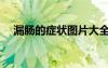 漏肠的症状图片大全（漏肠的症状图片）